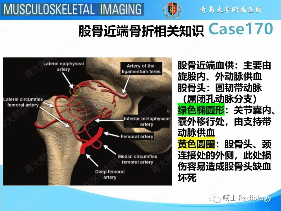 影像PPT - 【PPT】股骨术后并发症-17