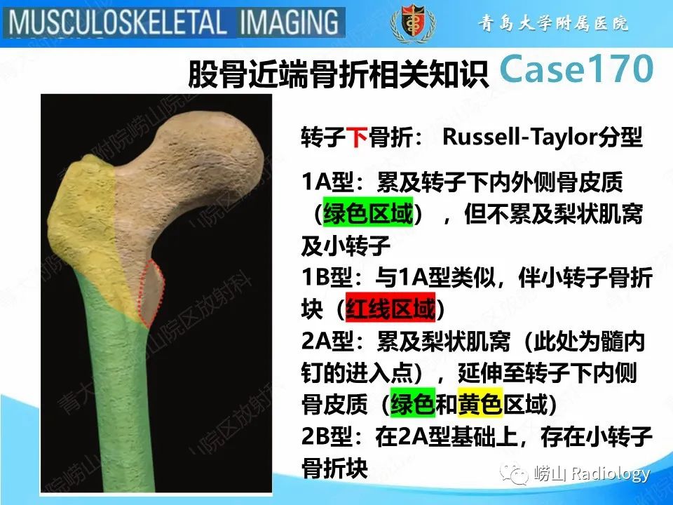 影像PPT - 【PPT】股骨术后并发症-24
