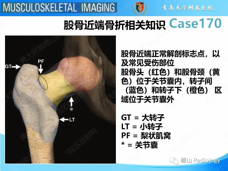 影像PPT - 【PPT】股骨术后并发症-2