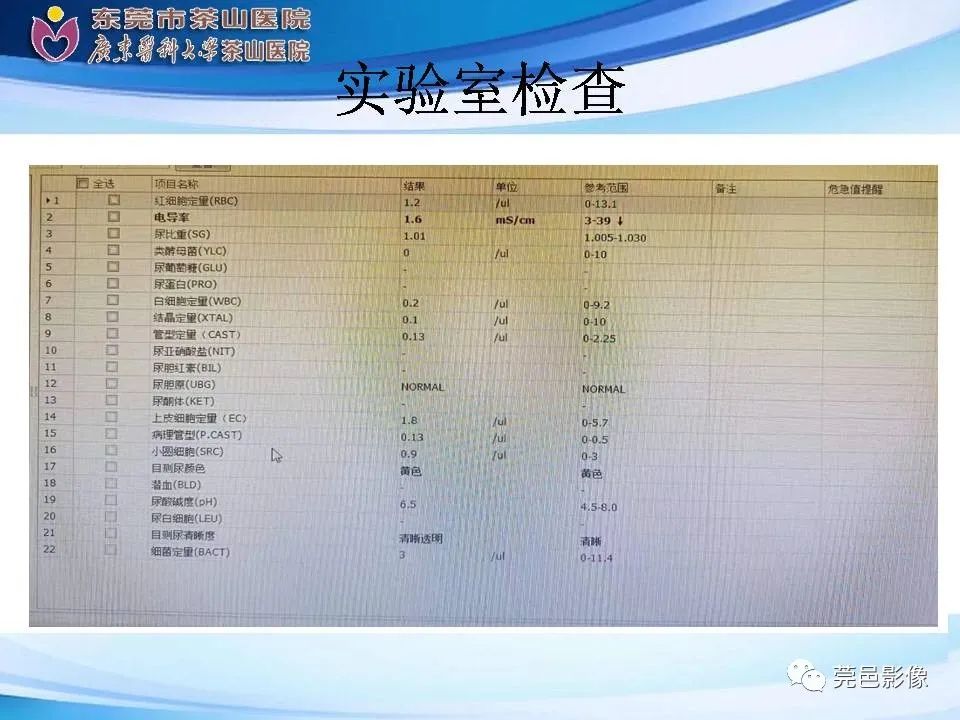 影像PPT - 【PPT】乏脂肪肾血管平滑肌脂肪瘤影像诊断-3