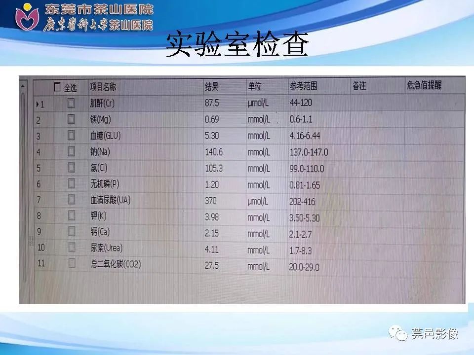 影像PPT - 【PPT】乏脂肪肾血管平滑肌脂肪瘤影像诊断-5