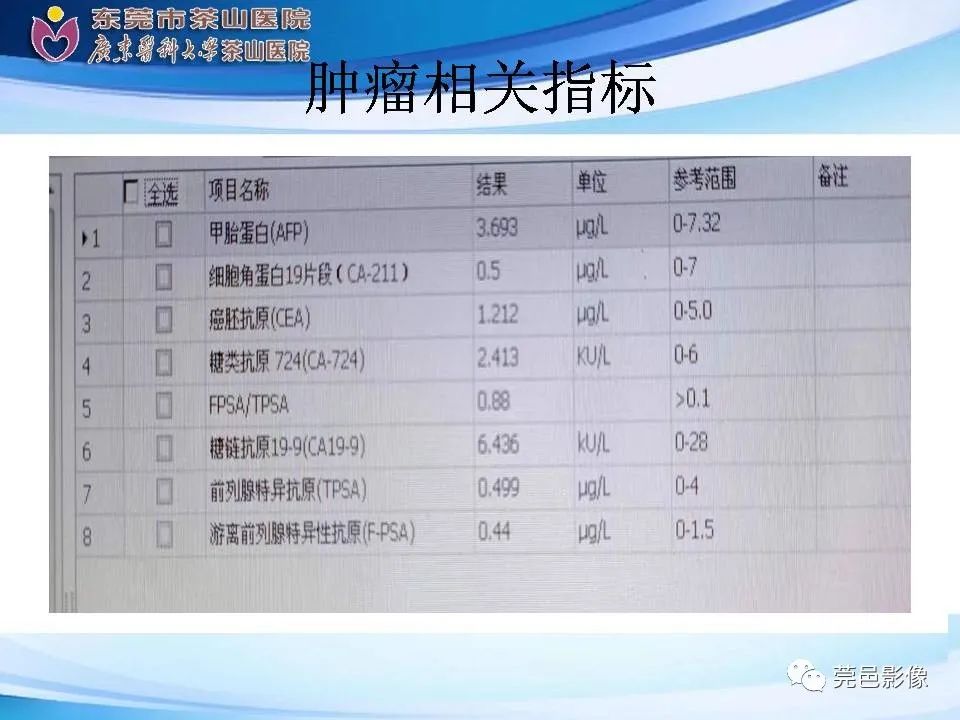 影像PPT - 【PPT】乏脂肪肾血管平滑肌脂肪瘤影像诊断-6