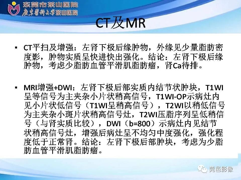 影像PPT - 【PPT】乏脂肪肾血管平滑肌脂肪瘤影像诊断-10