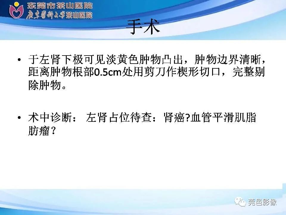 影像PPT - 【PPT】乏脂肪肾血管平滑肌脂肪瘤影像诊断-11