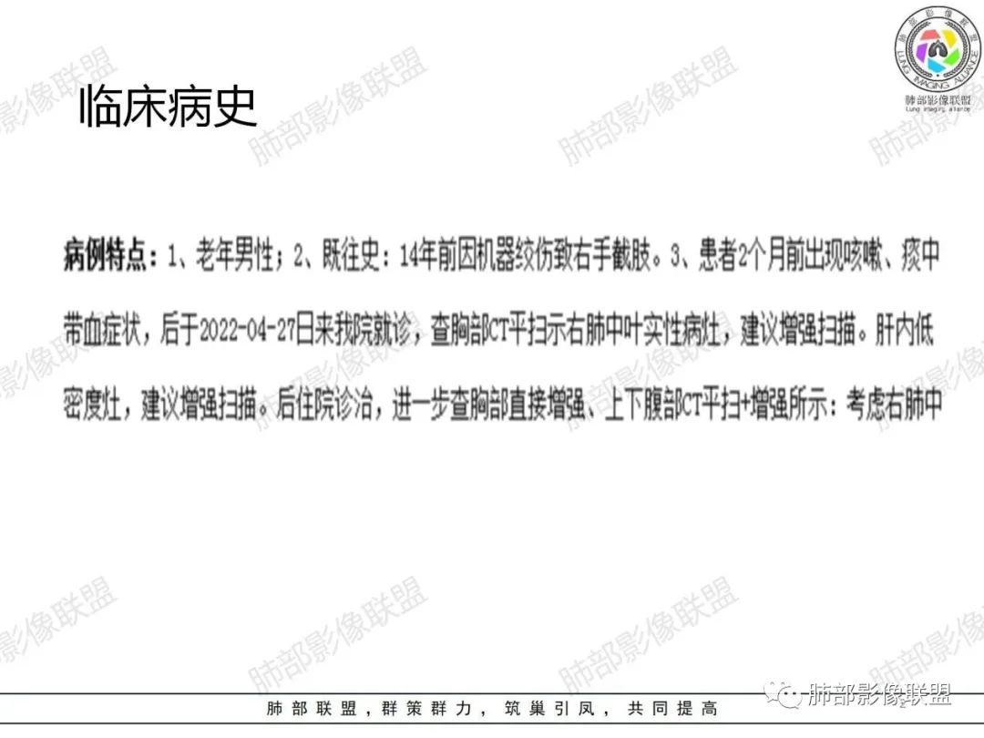 影像PPT - 【病例】小细胞肺癌一图定乾坤—经典蠕虫样改变-2 影像PPT - 【病例】小细胞肺癌一图定乾坤—经典蠕虫样改变-2