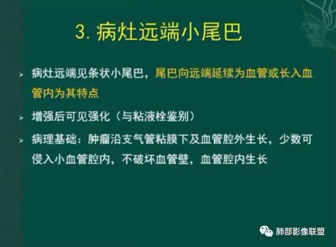 影像PPT - 【病例】小细胞肺癌一图定乾坤—经典蠕虫样改变-41 影像PPT - 【病例】小细胞肺癌一图定乾坤—经典蠕虫样改变-41