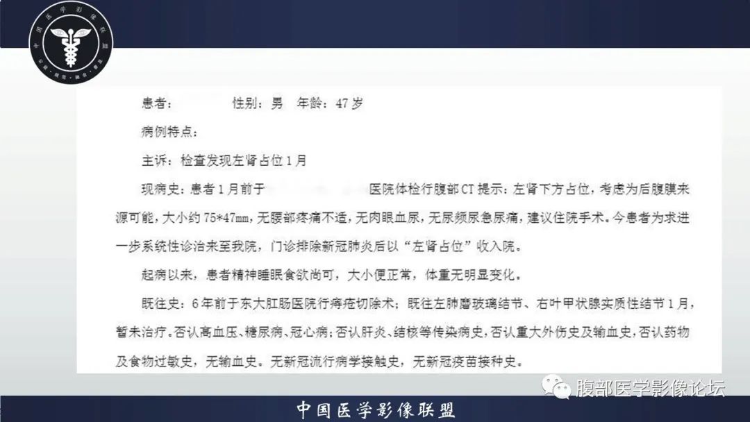 影像PPT - 【病例】肾脏上皮样血管平滑肌脂肪瘤1例CT影像诊断-2