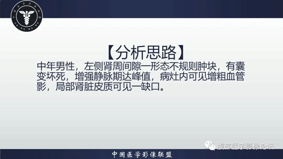 影像PPT - 【病例】肾脏上皮样血管平滑肌脂肪瘤1例CT影像诊断-10