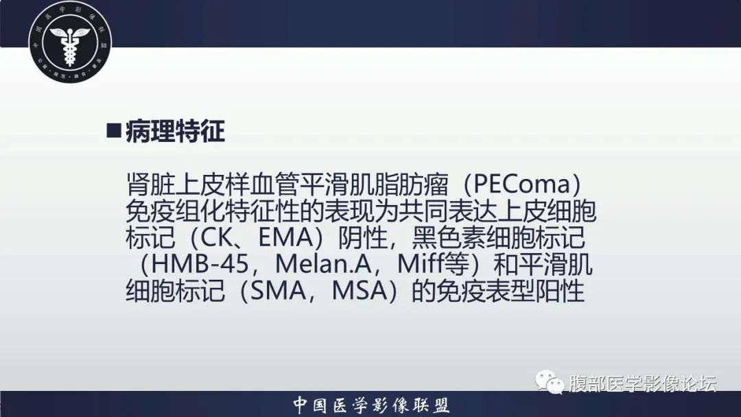影像PPT - 【病例】肾脏上皮样血管平滑肌脂肪瘤1例CT影像诊断-22