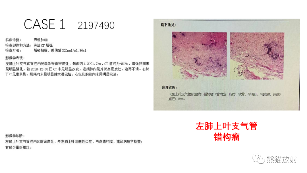 影像PPT - 【病例】支气管错构瘤 VS 支气管异物-15