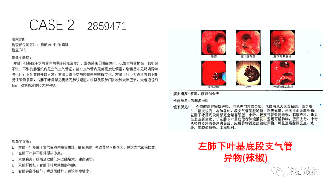 影像PPT - 【病例】支气管错构瘤 VS 支气管异物-16