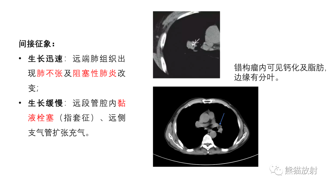 影像PPT - 【病例】支气管错构瘤 VS 支气管异物-20