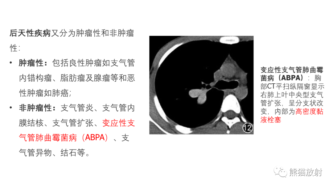 影像PPT - 【病例】支气管错构瘤 VS 支气管异物-1