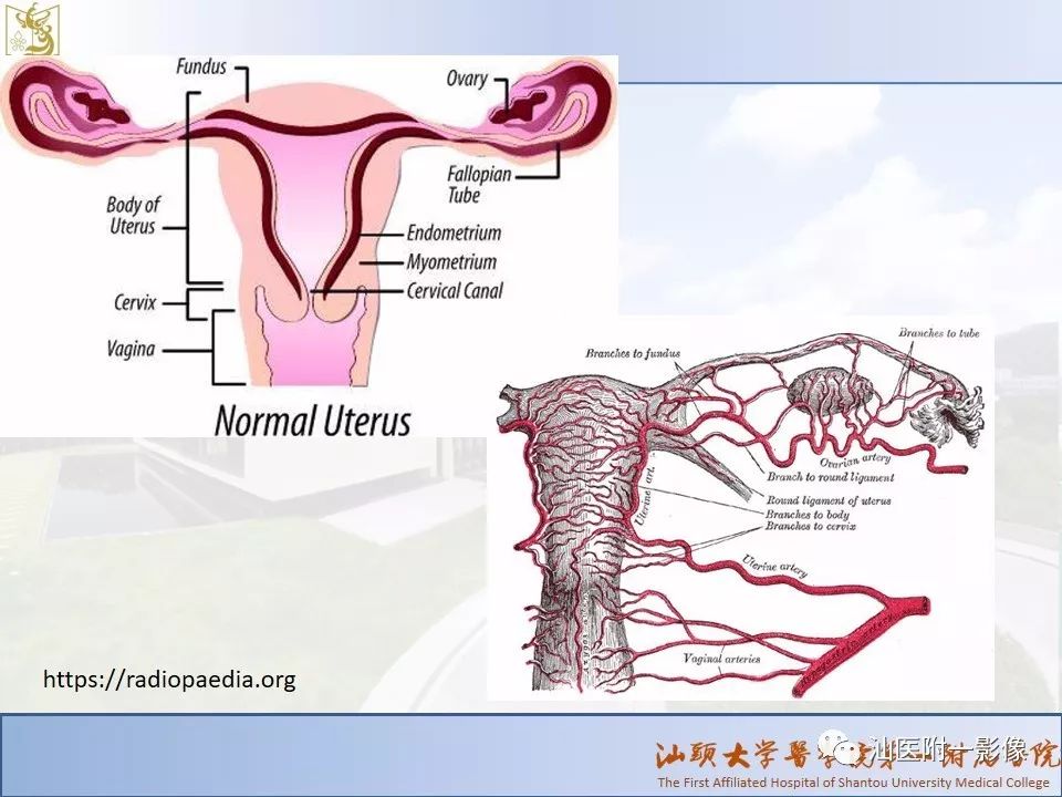 影像PPT - 【PPT】妇科急腹症的CT和MRI诊断-3