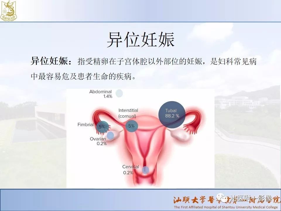 影像PPT - 【PPT】妇科急腹症的CT和MRI诊断-15