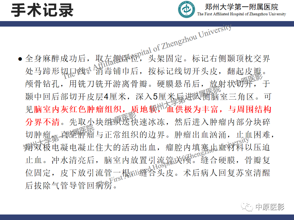 影像PPT - 【病例】侧脑室胶质母细胞瘤1例MR影像-11