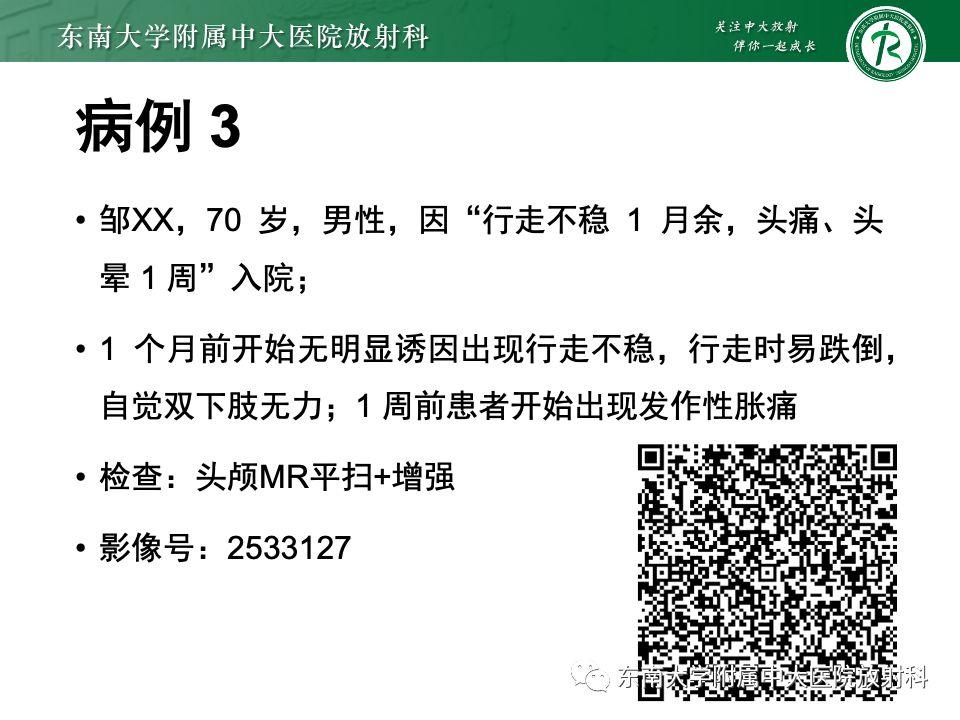 影像PPT - 【PPT】颅内常见囊性病变诊断-7