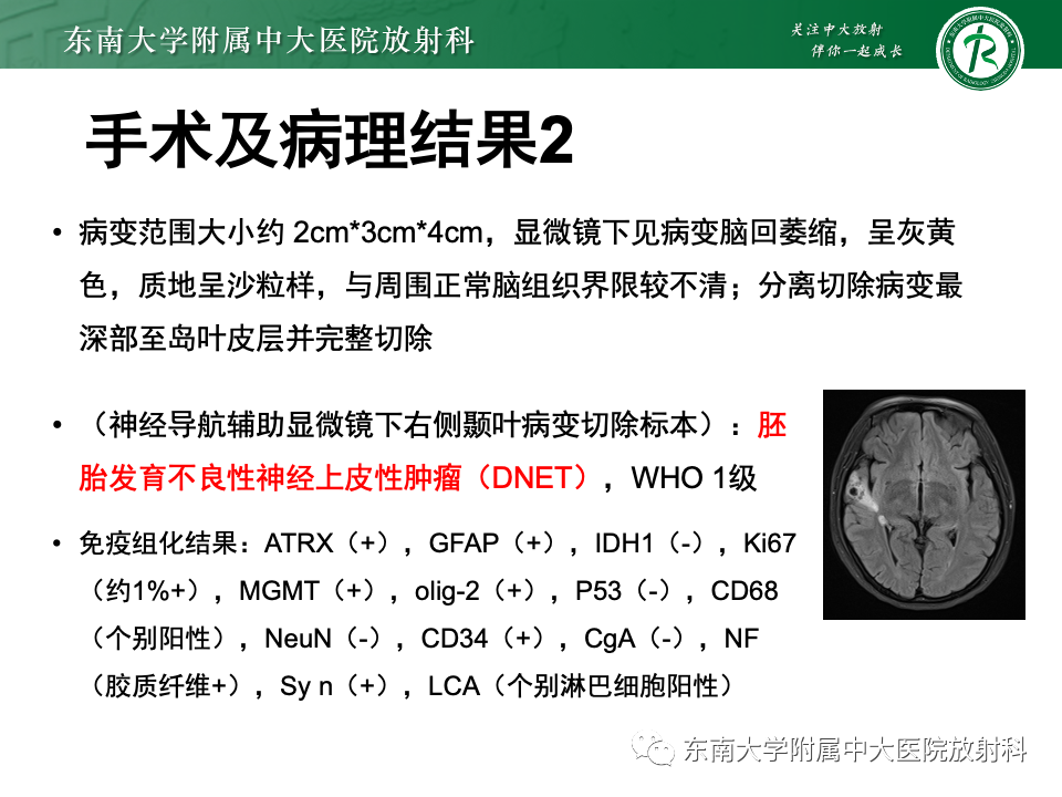 影像PPT - 【PPT】颅内常见囊性病变诊断-12