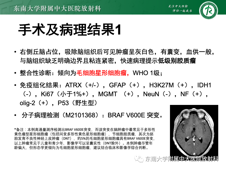影像PPT - 【PPT】颅内常见囊性病变诊断-11