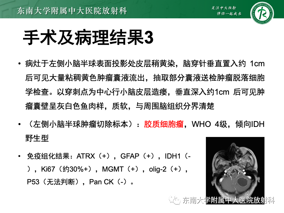 影像PPT - 【PPT】颅内常见囊性病变诊断-13