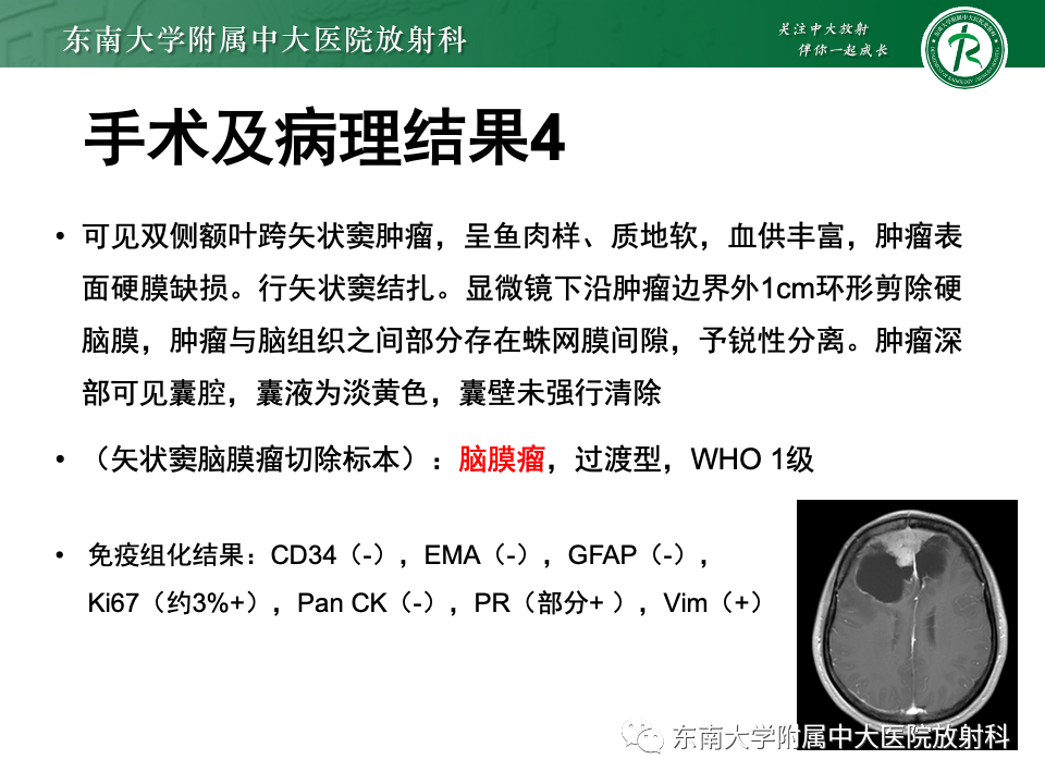 影像PPT - 【PPT】颅内常见囊性病变诊断-14