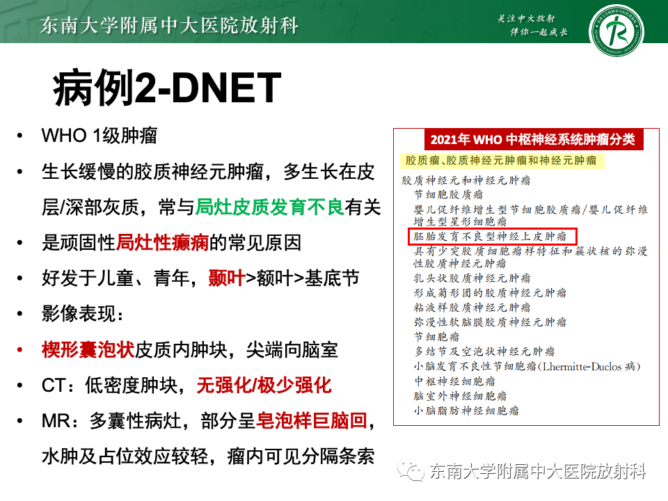 影像PPT - 【PPT】颅内常见囊性病变诊断-19