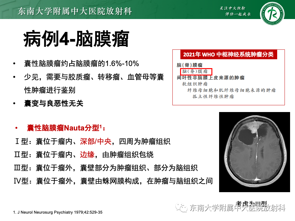 影像PPT - 【PPT】颅内常见囊性病变诊断-22