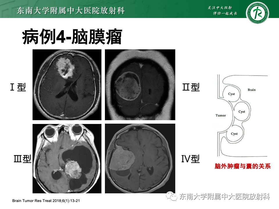 影像PPT - 【PPT】颅内常见囊性病变诊断-23