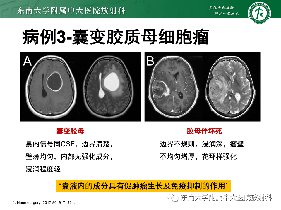 影像PPT - 【PPT】颅内常见囊性病变诊断-21