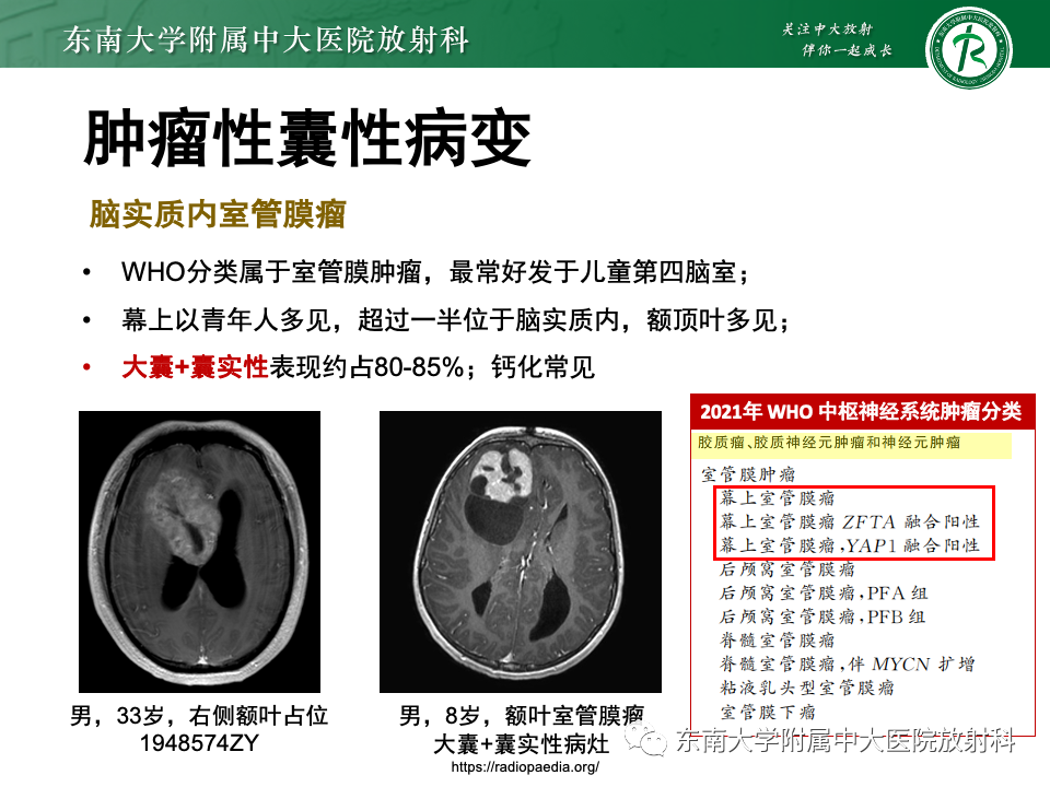 影像PPT - 【PPT】颅内常见囊性病变诊断-28