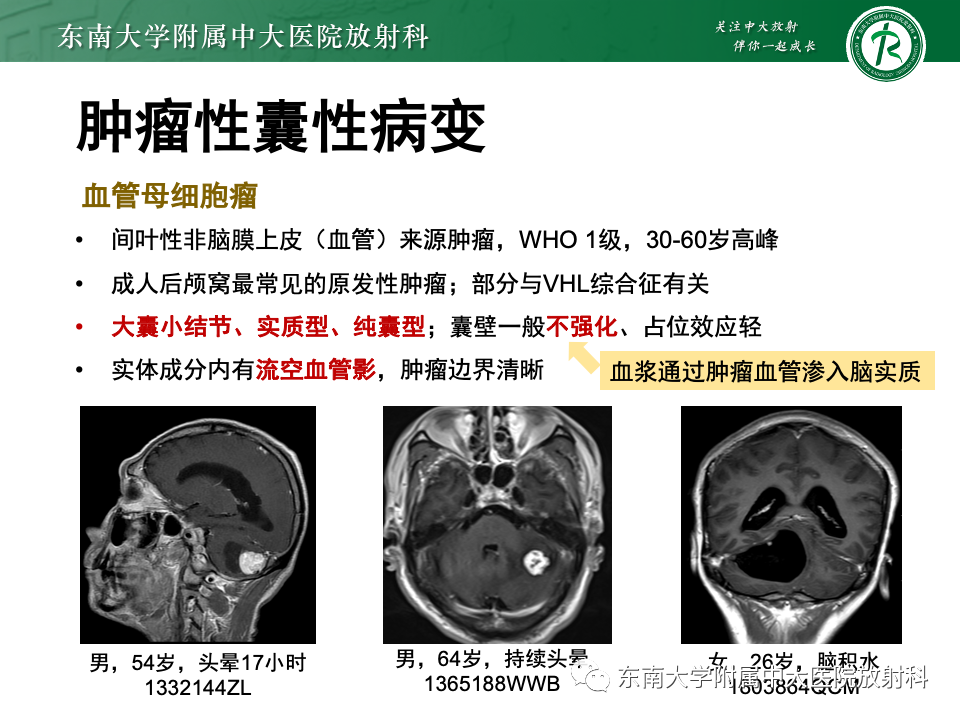 影像PPT - 【PPT】颅内常见囊性病变诊断-29