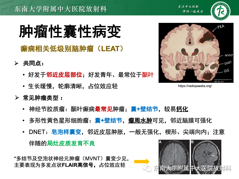 影像PPT - 【PPT】颅内常见囊性病变诊断-30