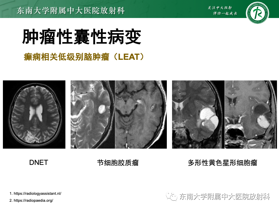 影像PPT - 【PPT】颅内常见囊性病变诊断-31