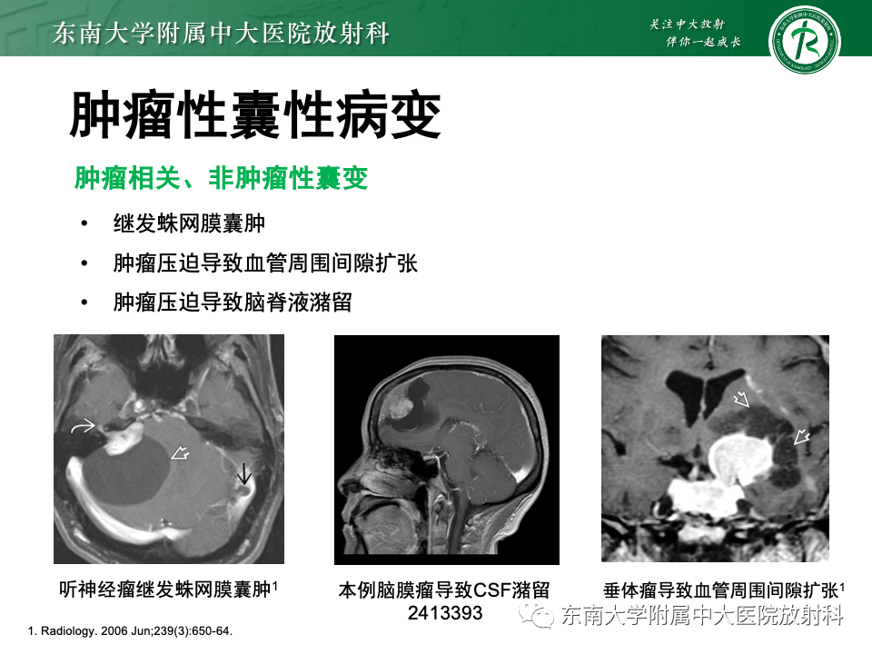 影像PPT - 【PPT】颅内常见囊性病变诊断-37
