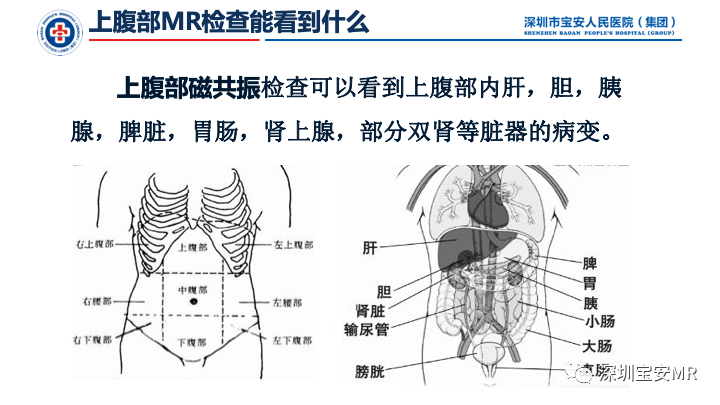 影像PPT - 【PPT】上腹部磁共振检查-3
