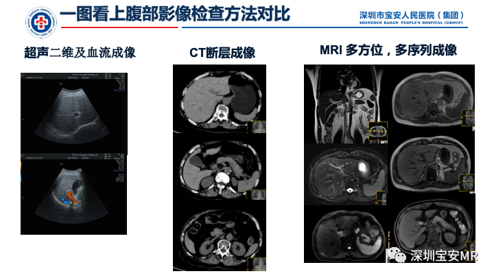 影像PPT - 【PPT】上腹部磁共振检查-5