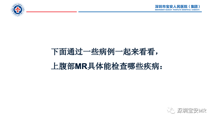 影像PPT - 【PPT】上腹部磁共振检查-6