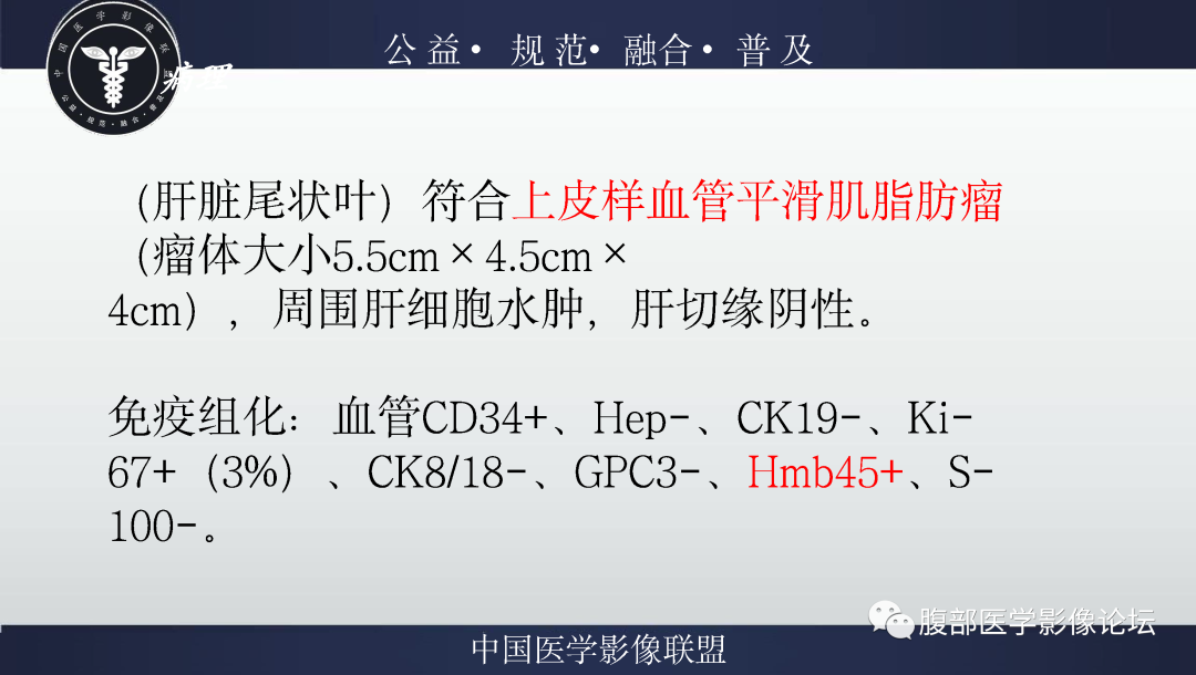 影像PPT - 【病例】肝脏上皮样血管平滑肌脂肪瘤1例影像诊断-15