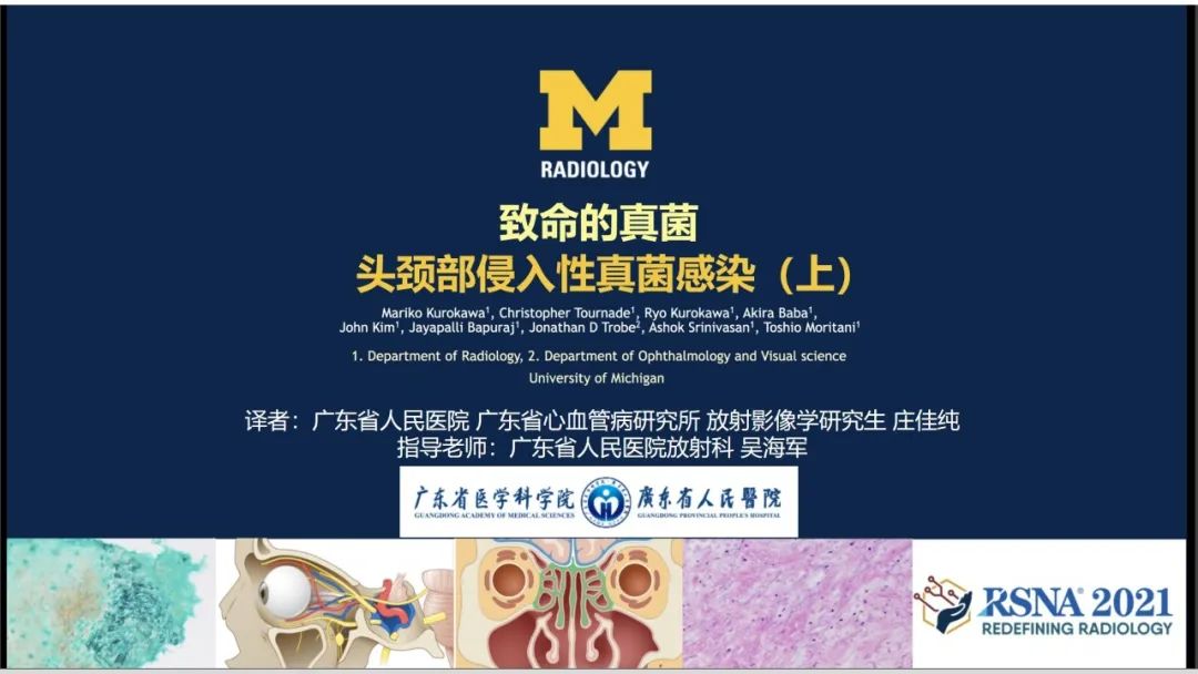 影像PPT - 【PPT】致命的真菌：头颈部侵入性真菌感染-2