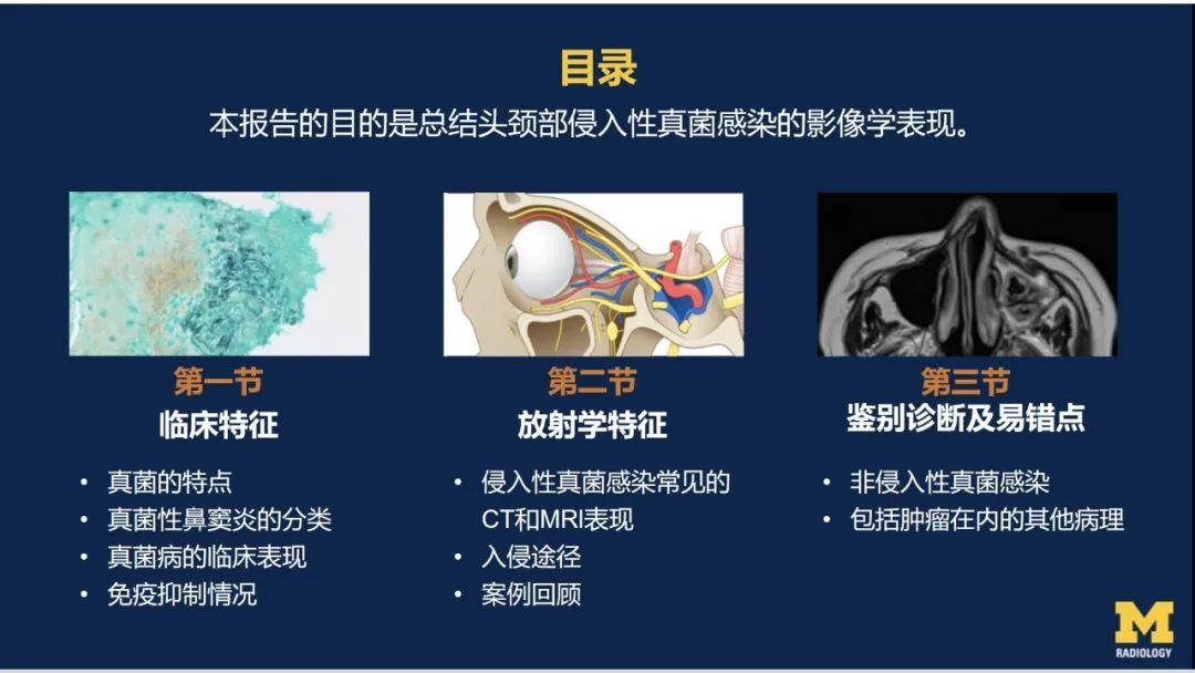 影像PPT - 【PPT】致命的真菌：头颈部侵入性真菌感染-6