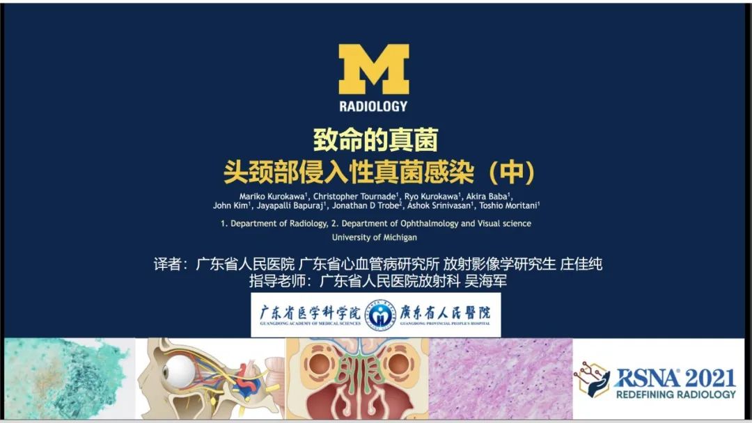 影像PPT - 【PPT】致命的真菌：头颈部侵入性真菌感染-23
