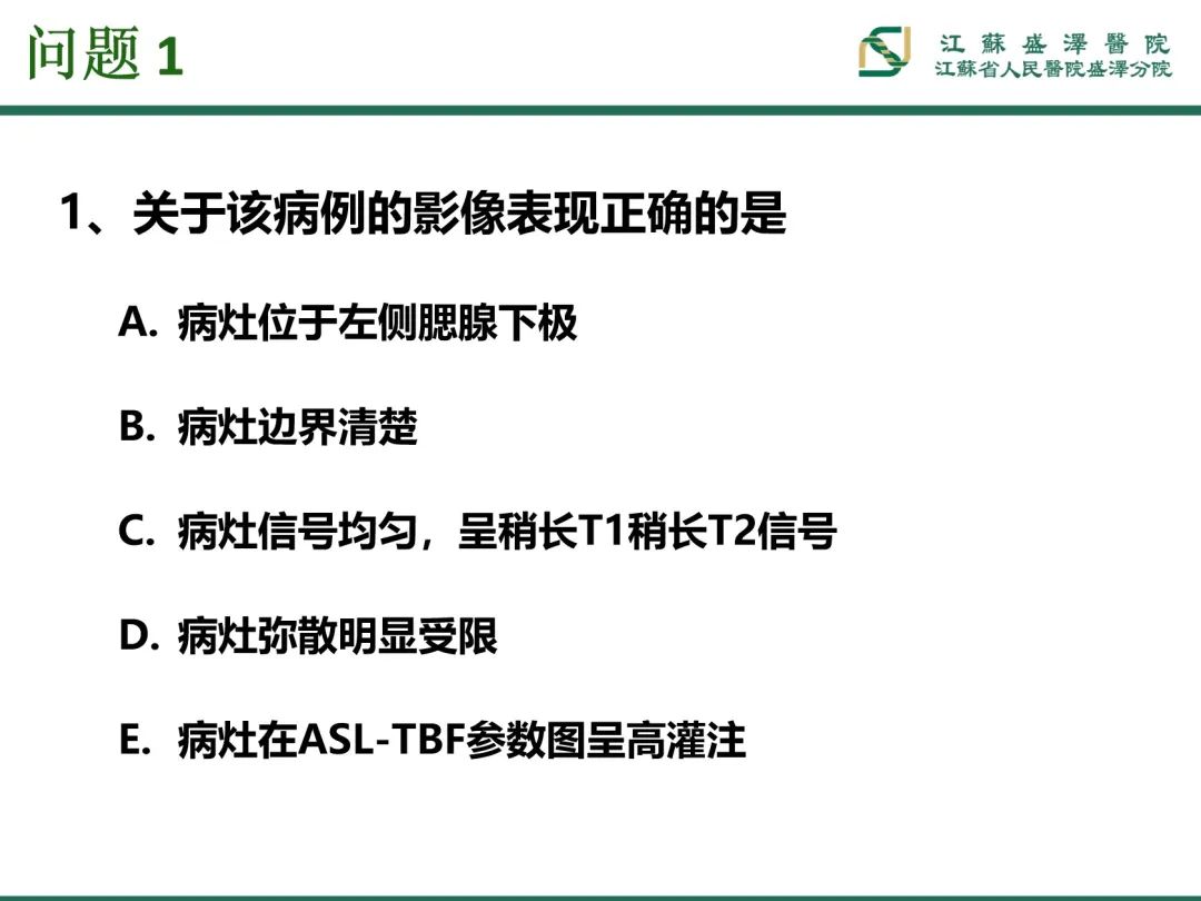 影像PPT - 【PPT】腮腺腺淋巴瘤-9