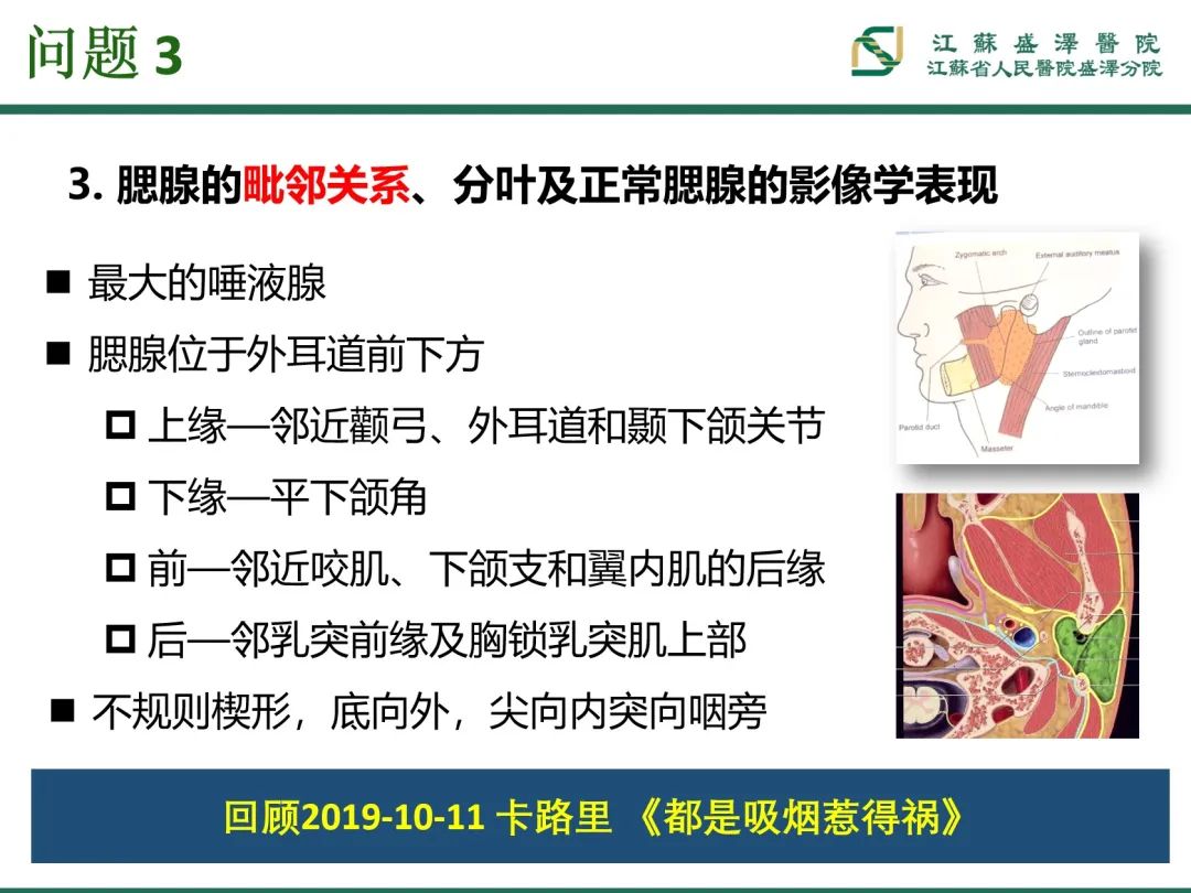 影像PPT - 【PPT】腮腺腺淋巴瘤-15