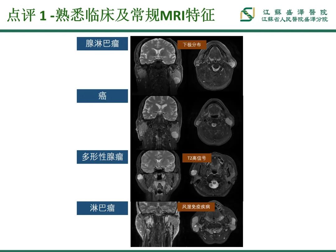 影像PPT - 【PPT】腮腺腺淋巴瘤-32