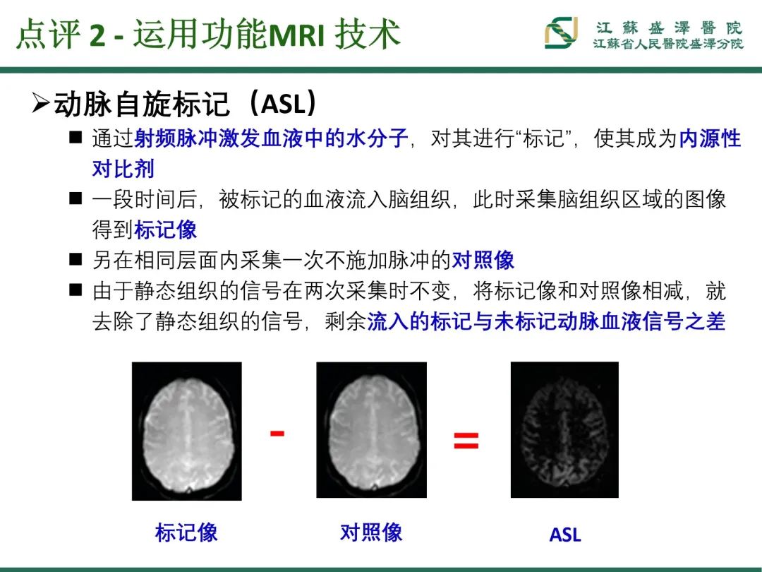 影像PPT - 【PPT】腮腺腺淋巴瘤-34