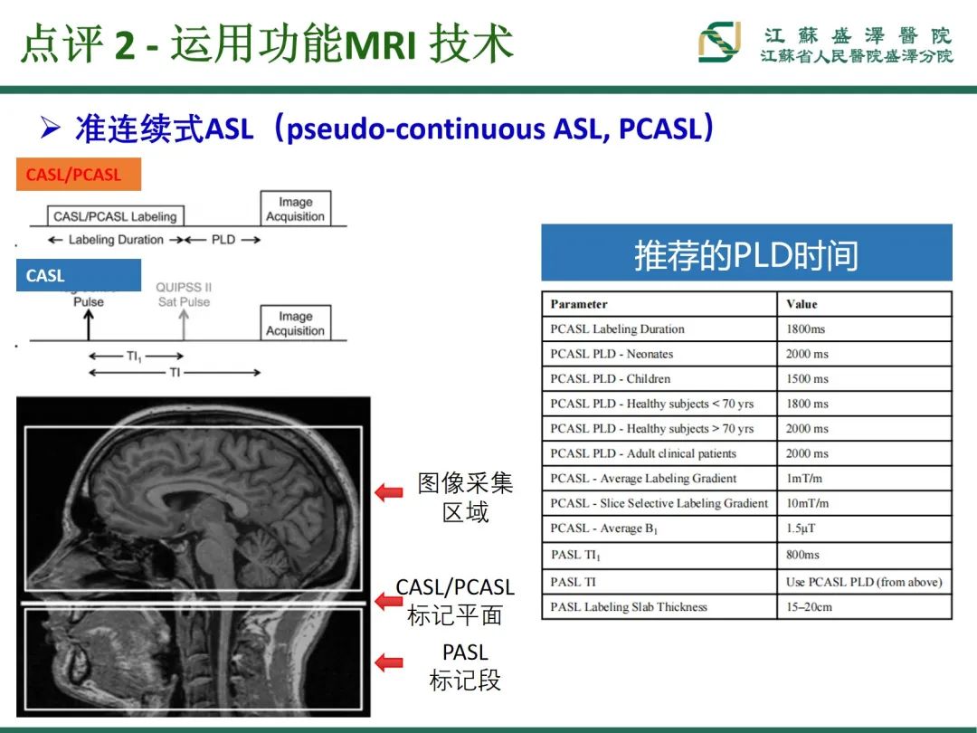 影像PPT - 【PPT】腮腺腺淋巴瘤-36
