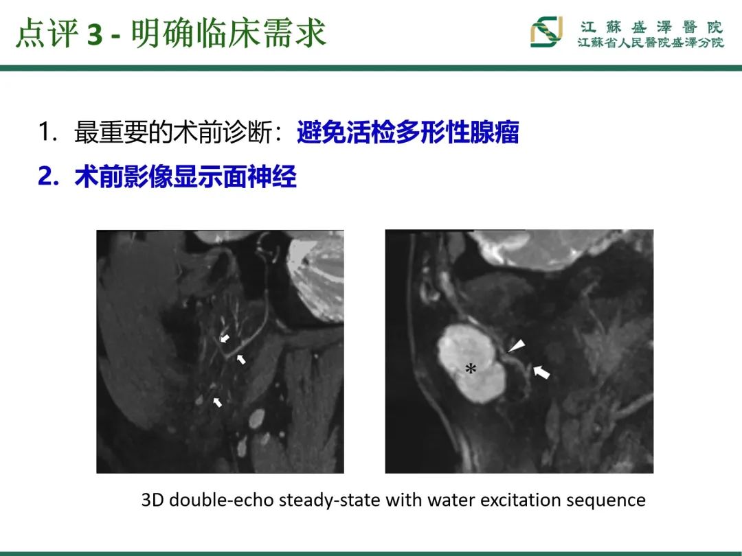 影像PPT - 【PPT】腮腺腺淋巴瘤-37