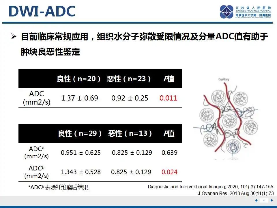 影像PPT - 【PPT】卵巢环状小管性索肿瘤-23