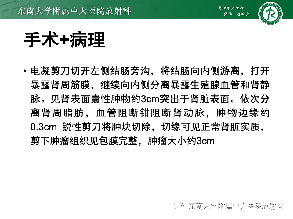 影像PPT - 【PPT】囊性肾癌-4