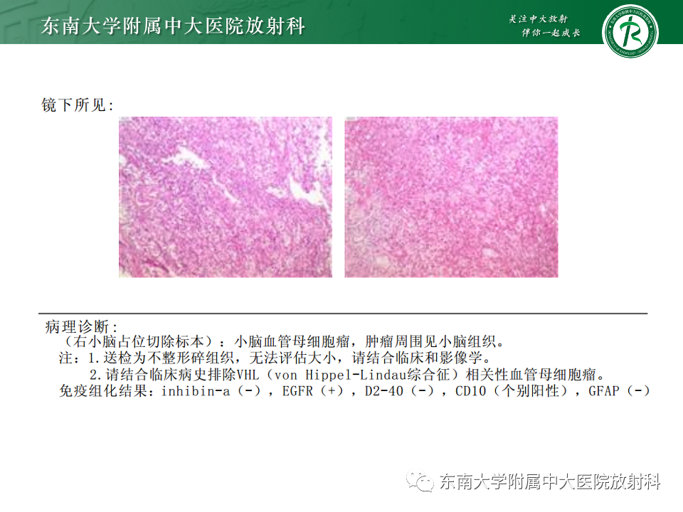影像PPT - 【PPT】囊性肾癌-38